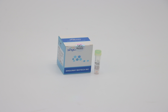 کیت یک مرحله ای آنفلوانزا PCR نمونه کیت تست نوکلئیک اسید سواب بینی CE