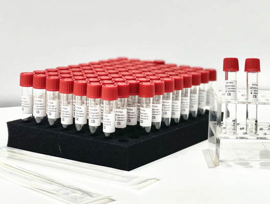 کیت استخراج معرف PCR یک مرحله ای از سواب حلق بیمار